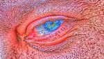 Eye
