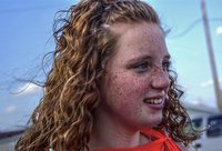 Freckles