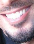 My_teeth