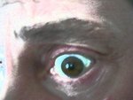 Eye